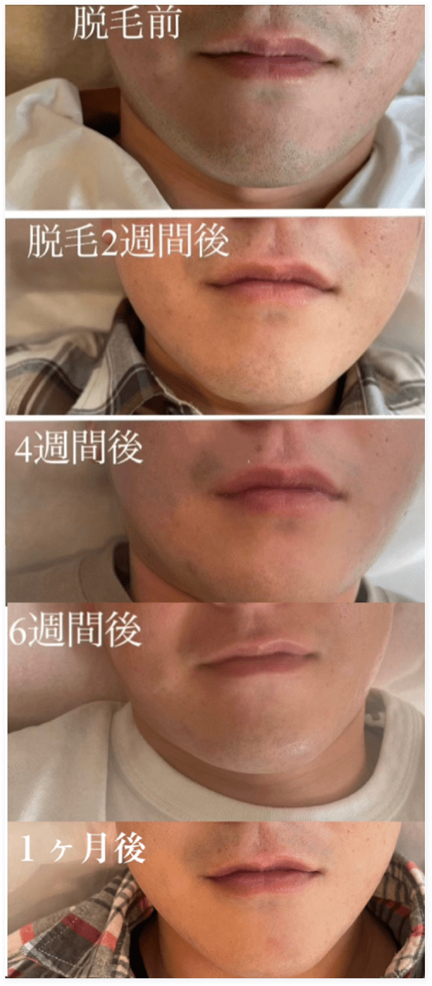 BEFORE・AFTER画像01