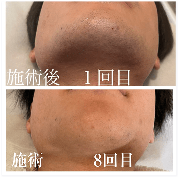 BEFORE・AFTER画像02