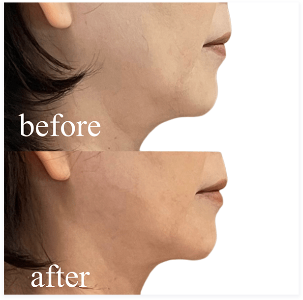 BEFORE・AFTER画像01