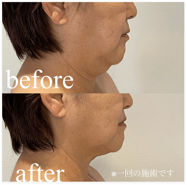 BEFORE・AFTER画像02