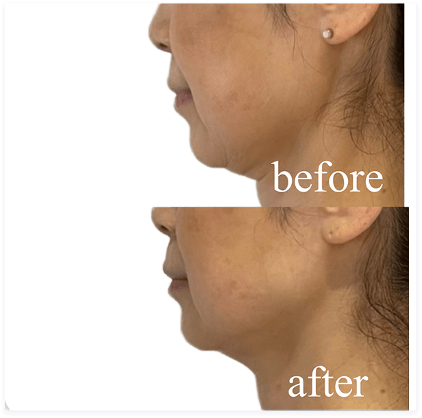 BEFORE・AFTER画像03