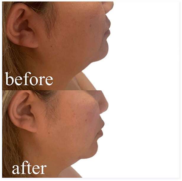 BEFORE・AFTER画像04