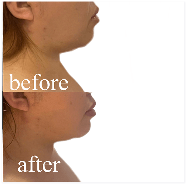 BEFORE・AFTER画像05