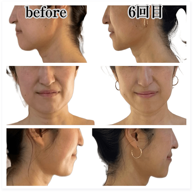BEFORE・AFTER画像06