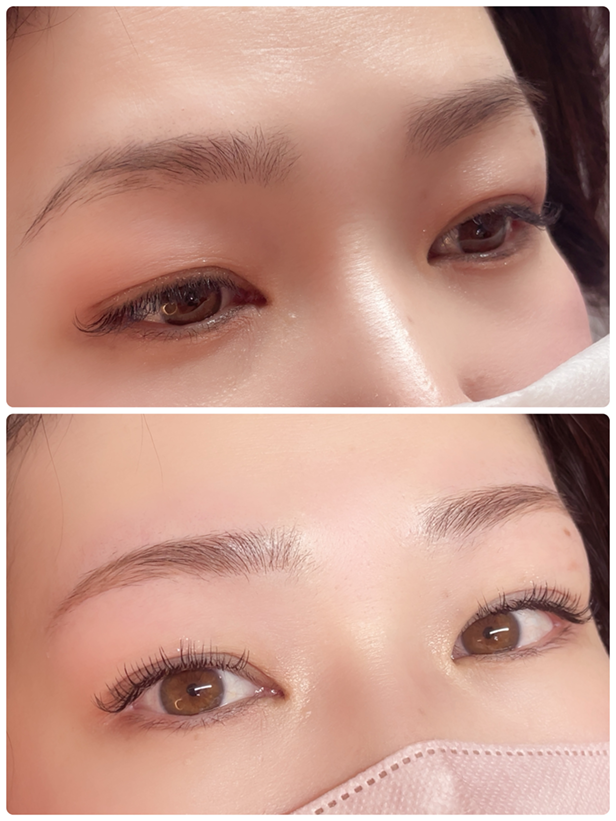 アートメイクBEFORE・AFTER画像1