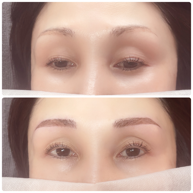 アートメイクBEFORE・AFTER画像2