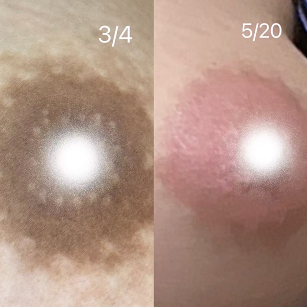 アートメイクBEFORE・AFTER画像4