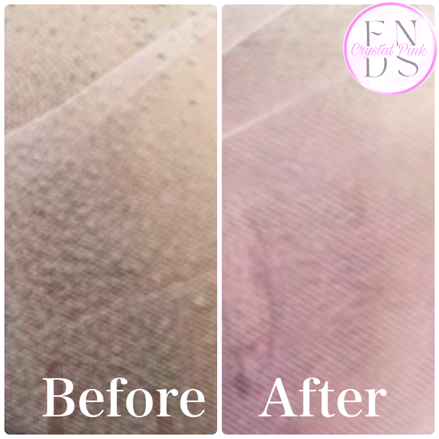 アートメイクBEFORE・AFTER画像5