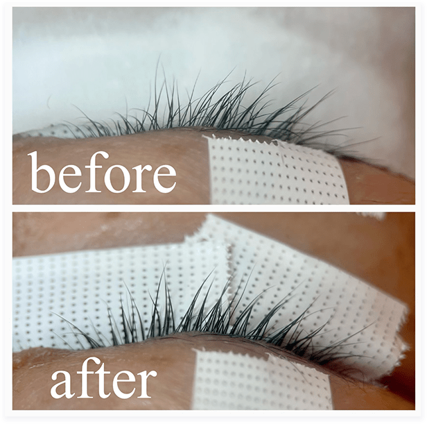 BEFORE・AFTER画像02