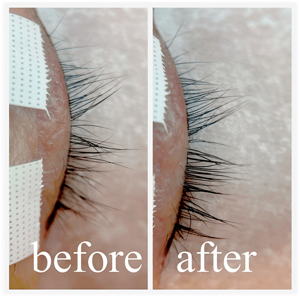 BEFORE・AFTER画像03