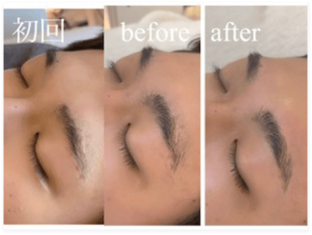 BEFORE・AFTER画像04