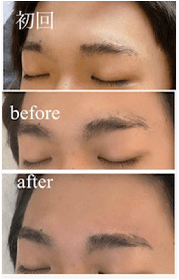 BEFORE・AFTER画像05