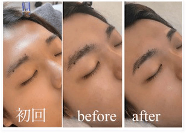 BEFORE・AFTER画像06