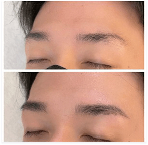 BEFORE・AFTER画像07