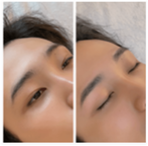 BEFORE・AFTER画像08