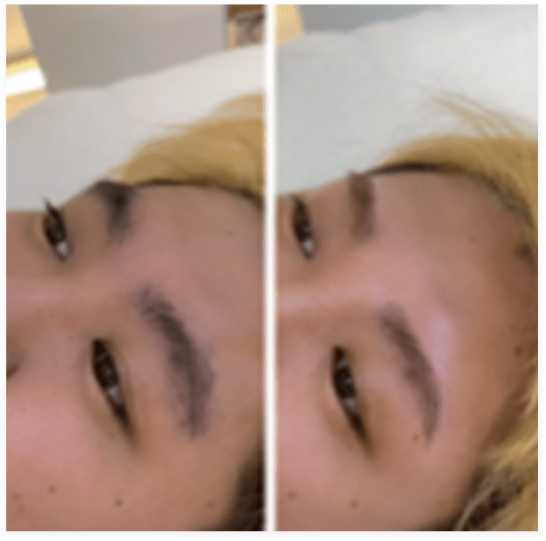 BEFORE・AFTER画像09