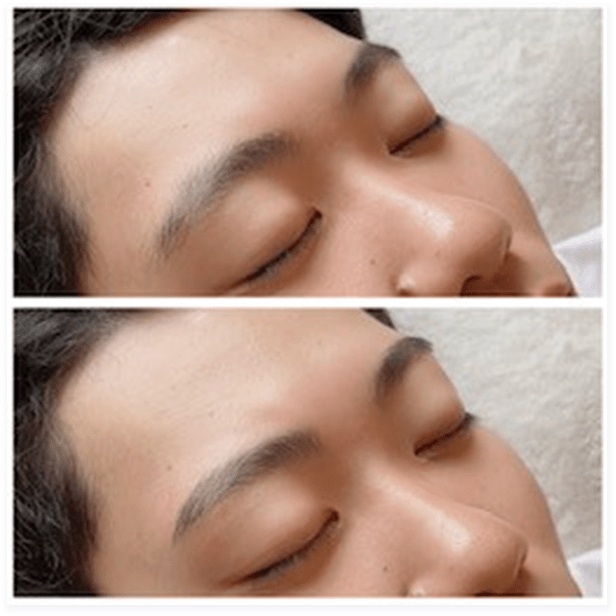 BEFORE・AFTER画像10